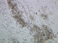 �A�W�݂̈̓��e��