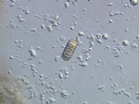 ���̐H�ׂĂ�����e